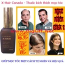 Tp. Hồ Chí Minh: X-Hair Canada - Thuốc Mọc tóc cao cấp - Sp Giúp mọc tóc một cách tự nhiên CL1158142P2