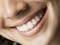 [2] Nụ cười với răng sứ