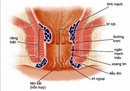 Tp. Hà Nội: Nguyên nhân Bệnh trĩ nội CL1407833