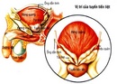 Tp. Hồ Chí Minh: Bệnh Phì đại tiền liệt tuyến và thuốc điều trị TL-phythizol RSCL1160653