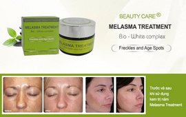 Kem trị nám Beauty Care Melasma Treatment xóa mờ nám, tàn nhang hiệu quả nhất