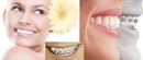 Tp. Hà Nội: Một vào tiêu chuẩn để lựa chọn một phòng khám răng hàm mặt niềng răng tốt. CL1680126P4
