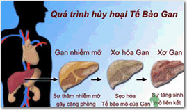 Những nguyên nhân gan nhiễm mỡ là gì