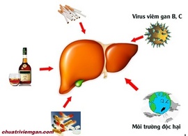 Uống thuốc giải độc gan trị mụn nào tốt nhất